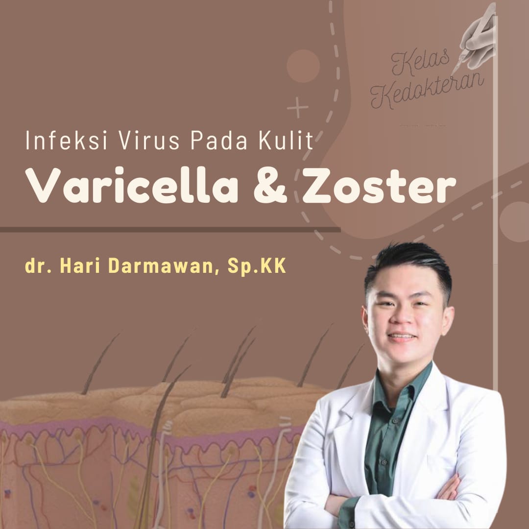 Infeksi Virus Pada Kulit Varicella & Zoster